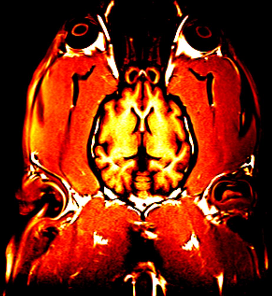 IRM cerveau de Hyène